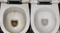 Ein halbes Glas dieser Lösung – und die Toilette glänzt wie im Hotel: Geheimtipp vom Reinigungsexperten